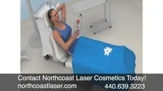 Coolsculpting Cleveland, Northcoast Laser Cosmetics