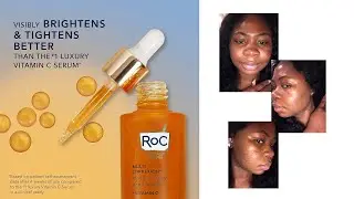 30 DAYS on roc vitamin C serum