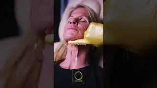 Neck lines & wrinkles? Morpheus8 to the rescue! 💥