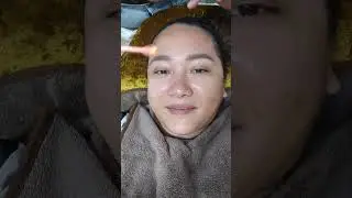 Korean Glass Skin, Laser Hair Removal and Whitening, Slimming at The Elixir Aesthetics Center Argao