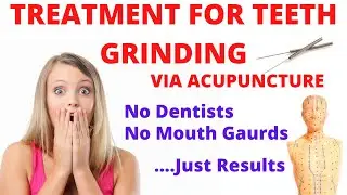 Teeth Grinding Treatment (Bruxism) with Acupuncture | Same Day Results | Acupuncture in London