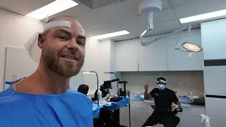 What it&rsquo;s like having a hair transplant
