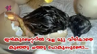 വിരിയിക്കാൻ വച്ചാൽ മുട്ടക്കുള്ളിലിരുന്ന് കുഞ്ഞ് ചാവുന്നുണ്ടോ | kozhi valarthal | Aviyal media by Das