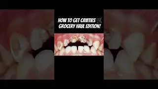 How to get Cavities. (Or not to get cavities)