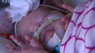 Next Time: Micro Preemies