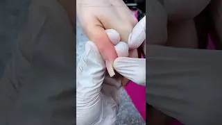 ЧИНЮ ноготь гам полигелем