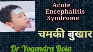 ACUTE  ENCEPHALITIS  SYNDROME ( CHAMKI  FEVER )  IN  BIHAR  ...IN ENGLISH