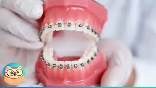 Dental Braces: How do they work?