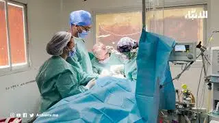 أطباء المركز الاستشفائي الجامعي محمد السادس بمراكش يعيدون الابتسامة إلى أصحاب الشفة الأرنبية
