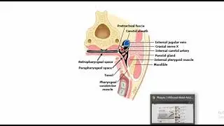 DNSI(Deep neck space infections) ENT