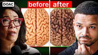 THIS Is Worse For Your BRAIN Than JUNK FOOD..