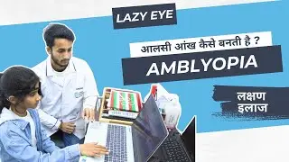 Amblyopia: The Silent Vision Killer | Causes, Risks & Treatment
