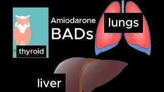 Common SIDE EFFECTS of Amiodarone you MUST know