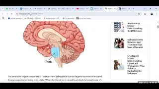 BHB--11Locomotor System - Brainstem,Pons, Medulla 22/3/2025