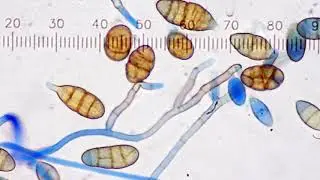 airborne mold spores