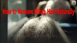 How to Remove White Hair Naturally