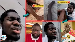 I feel like Dɣing🔥Young Don Criɛs, begs Otumfuo & Ajagurajah after doctor decide to &alpha;mput&alpha;tɛ his Leg