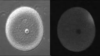 Fertilization - Calcium Wave
