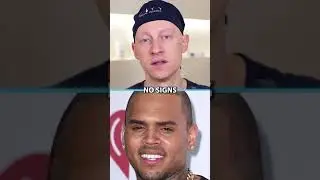 Did Chris Brown Have Plastic Surgery?