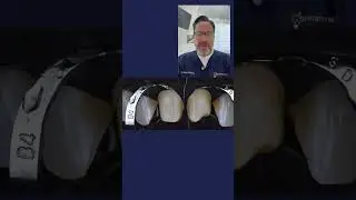 Isolation in Dentistry: Is Rubber Dam Really the Best?
