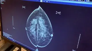 Check Up 13: The importance of regularly scheduled mammograms