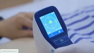 Peaksonic Bladder Scanner
