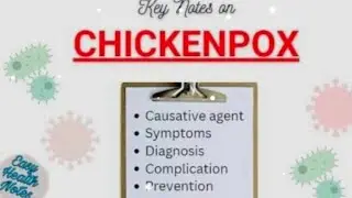 Chicken pox infection after kideny transplant 