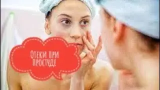 Чем убрать ОТЕКИ НА ЛИЦЕ при простуде и насморке? Тёмные круги и отёки.