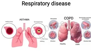 🌬️ Asthma vs COPD | Key Differences Explained with Animation | Health Education Shorts