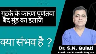 पान मसाला खाने के कारण बंद मुंह की सर्जरी || surgery for Oral submucous fibrosis