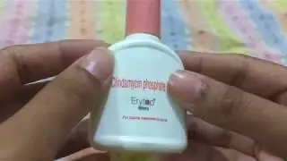 Erytop (clindamycin phosphate lotion) for acne