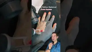 He is going to poop out his Tattoo - Doctor Explains