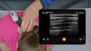 Cervical Ultrasound Anatomy