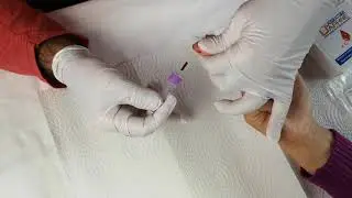 Vidéo prélèvement de sang capillaire IgG Food Test