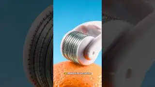How to grow a beard with a derma roller