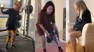Amputee woman exhibiting remarkable resilience and adaptability