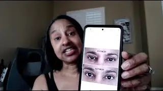 OMG Blaster Face and Neck FasciaBlasting with Timberley Gray