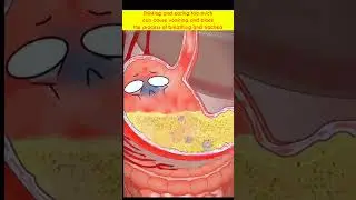 Drinking and eating too much can cause vomiting and block the process of breathing and trachea#asmr