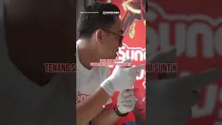 Sunat Modern SuperRing Tanpa Jarum Suntik🤩