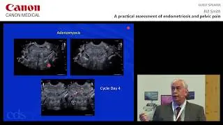 ISUOG 2018 Bill Smith - A Practical Assessment of Endometriosis and Pelvic Pain