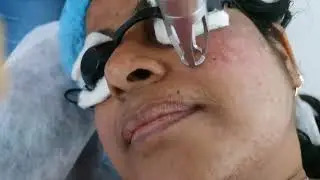 Hands On Training On Laser Therapies