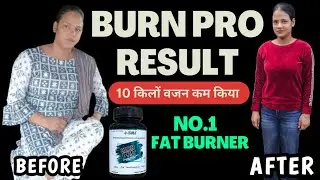 10 किलों वजन कम किया BURN PRO से | BURN PRO RESULT | WEIGHT LOSS SUPPLEMENTS | SUPPLEMENTS VILLA |