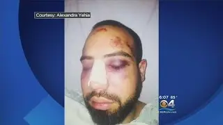 Police Chief & Union React To Police Brutality Allegation