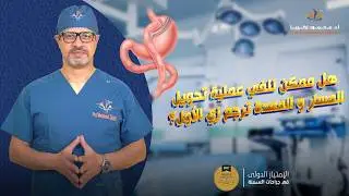 هل ممكن نلغي عملية تحويل المسار ونرجع المعدة زي الأول؟