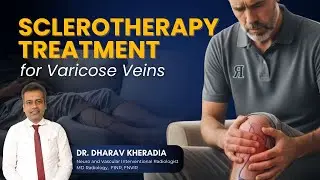 Varicose Veins Treatment Explained | VeinSeal & Foam Sclerotherapy | Dr. Dharav Kheradia