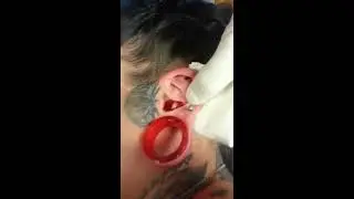 Conch Dermal Punch (8mm)