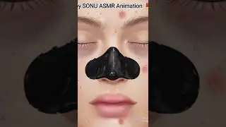 ASMR skin care blackhead removal animation #sonuasmranimation #skincare#blackheadremoval #stopmotion