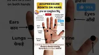 😳हाथ पर एक्यूप्रेशर बिंदु🔥😱 #viral #ytshorts #shorts #doctor #trending #draksinghbhu #youtubeshorts