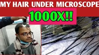 My hair under microscope | Hair heal talks.