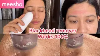 Meesho blackhead remover| Does it really work? | Affordable Meesho buy